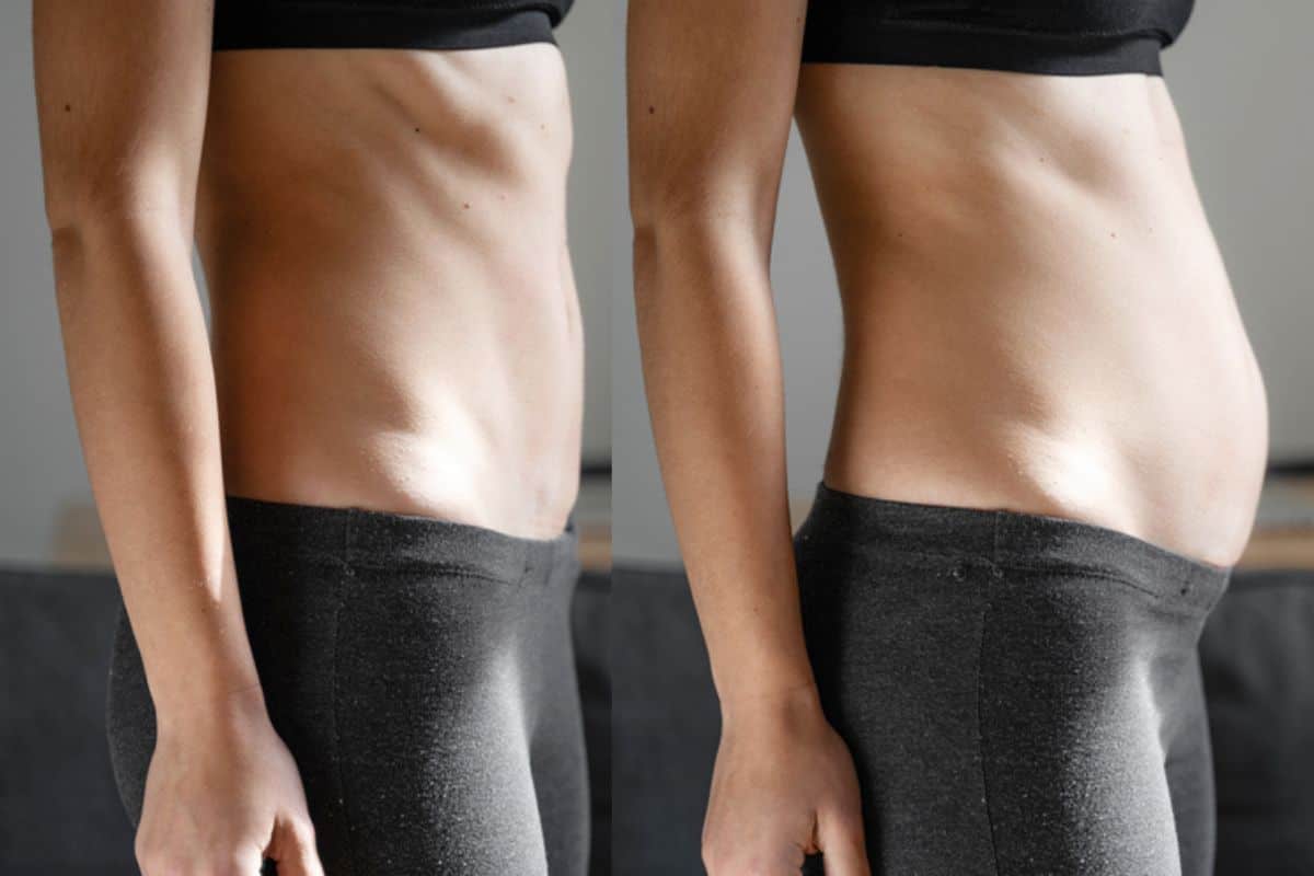 How long does diastasis recti take to improve North Wembley?