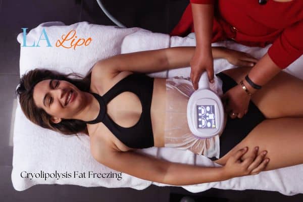 woman getting cryolipolysis North Wembley