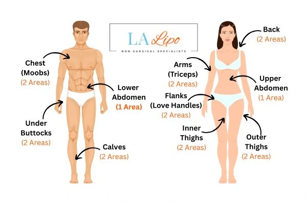 LA LIPO Cryolipolysis Areas North Wembley