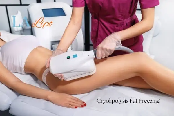 Woman receiving coolsculpting North Wembley treatment on her thighs