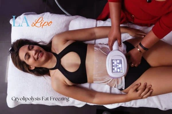 woman getting cryolipolysis North Wembley