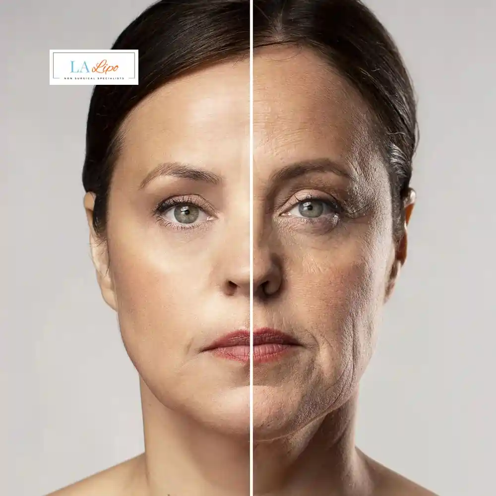 How Can You Tell If Non-Surgical Skin Tightening Is Right for You North Wembley?