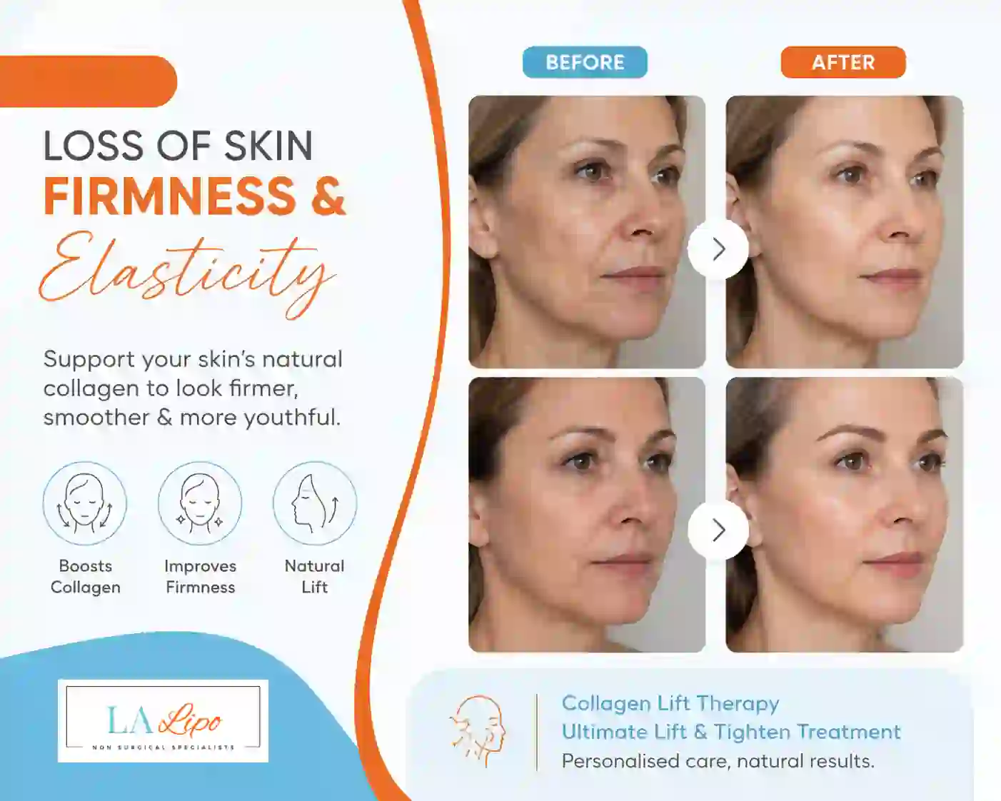 Sign #7: Loss of Skin Firmness and Elasticity North Wembley